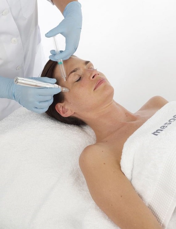 mpen mesoestetic faces e1615499986712 min